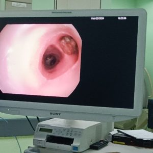 Rigid Bronchoscopy Workshop