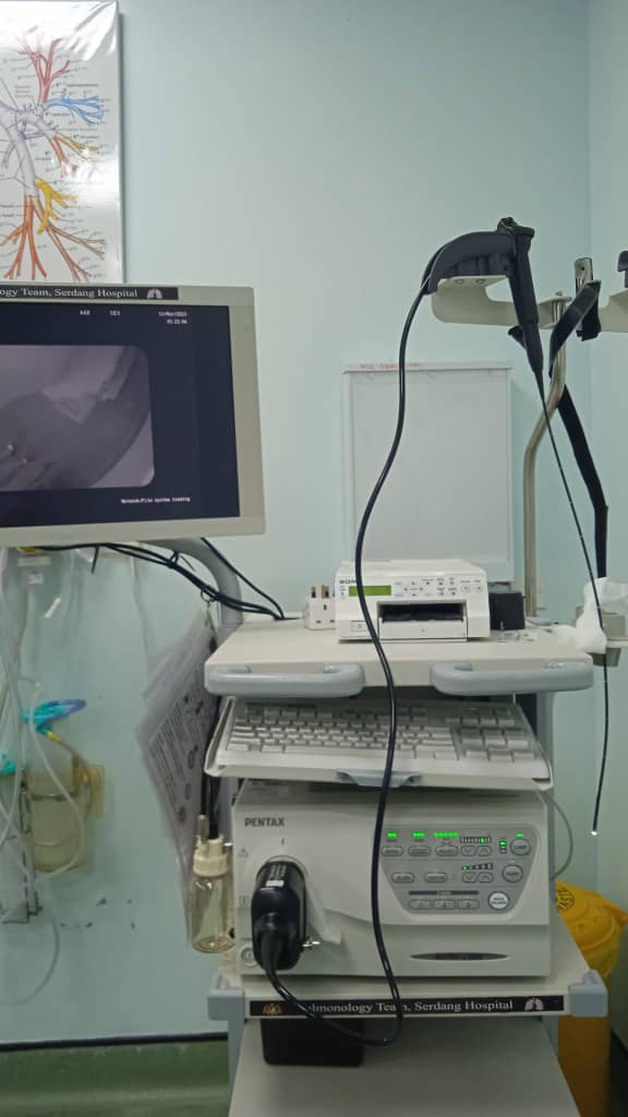 Flexible bronchoscopy